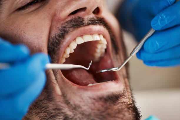Best Emergency Dental Care for Abscessed Tooth in Towamensing Trails, PA